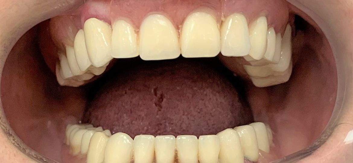 пациент на Saghir Dent